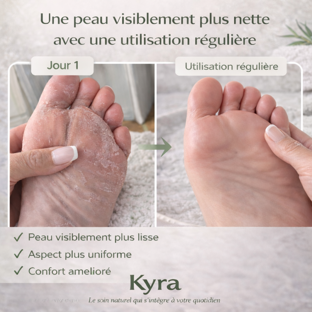 Savon Anti-Mycoses Kyra